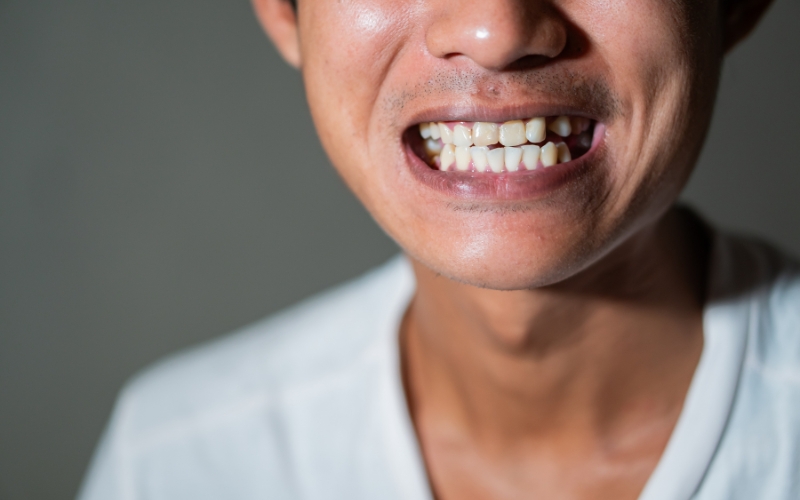 general dentist treats gum disease