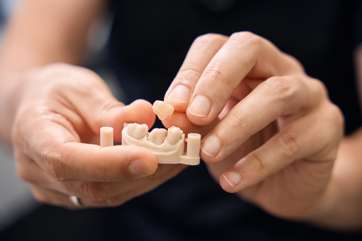 Dental Crowns in Ann Arbor