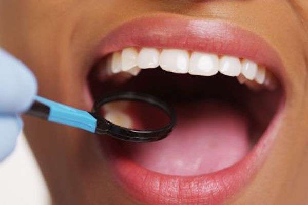 How a General Dentist Treats Cavities from Stadium Family Dentistry of Ann Arbor in Ann Arbor, MI
