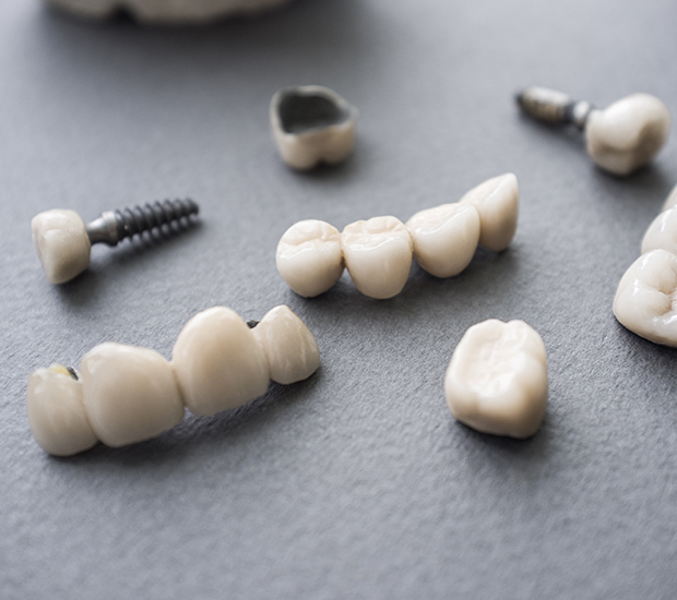 Ann Arbor The Difference Between Dental Implants and Mini Dental Implants